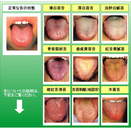 白い 舌 やつ の